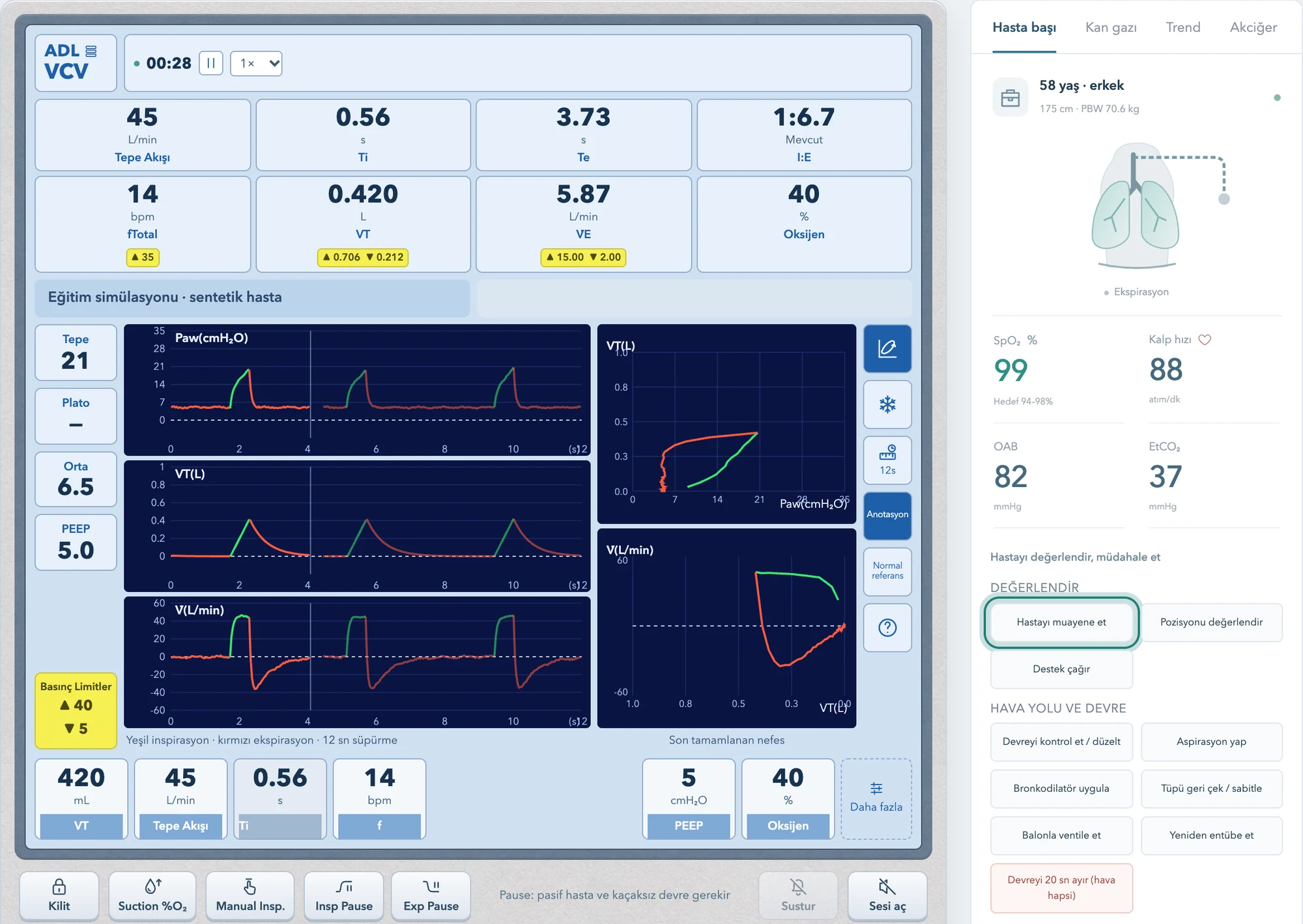 SOLUK's bedside screen: ventilator panel, waveforms, pressure-volume and flow-volume loops, patient assessment and interventions. Synthetic case, Turkish interface.